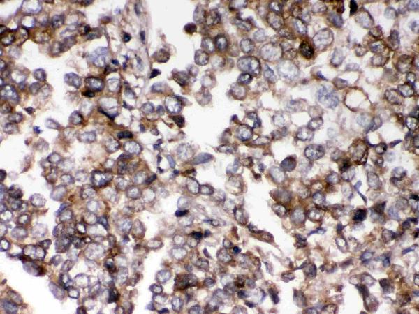 IHC analysis of AIM2 using anti-AIM2 antibody (PB9683).