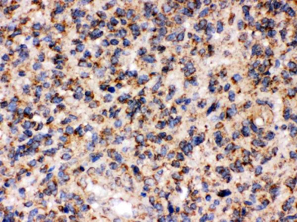 IHC analysis of FE65 using anti-FE65 antibody (PB9684).