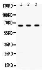 Western blot analysis of Chk2 using anti-Chk2 antibody (PB9692).