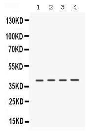 Western blot analysis of CSNK1A1 using anti-CSNK1A1 antibody (PB9693). Electrophoresis was performed on a 5-20% SDS-PAGE gel at 70V (Stacking gel) / 90V (Resolving gel) for 2-3 hours. The sample well of each lane was loaded with 50ug of sample under reducing conditions. Lane 1: Rat Brain Tissue Lysate, Lane 2: Rat Kidney Tissue Lysate, Lane 3: Mouse Kidney Tissue Lysate, Lane 4: HELA Whole Cell Lysate. After Electrophoresis, proteins were transferred to a Nitrocellulose membrane at 150mA for 50-90 minutes. Blocked the membrane with 5% Non-fat Milk/ TBS for 1.5 hour at RT. The membrane was incubated with rabbit anti-CSNK1A1 antigen affinity purified polyclonal antibody (Catalog # PB9693) at 0.5 μg/mL overnight at 4°C, then washed with TBS-0.1%Tween 3 times with 5 minutes each and probed with a goat anti-rabbit IgG-HRP secondary antibody at a dilution of 1:10000 for 1.5 hour at RT. The signal is developed using an Enhanced Chemiluminescent detection (ECL) kit (Catalog # EK1002) with Tanon 5200 system. A specific band was detected for CSNK1A1 at approximately 39KD. The expected band size for CSNK1A1 is at 39KD.