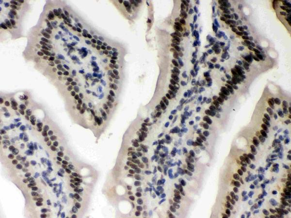 IHC analysis of CSNK1A1 using anti-CSNK1A1 antibody (PB9693). CSNK1A1 was detected in paraffin-embedded section of mouse intestine tissues. Heat mediated antigen retrieval was performed in citrate buffer (pH6, epitope retrieval solution) for 20 mins. The tissue section was blocked with 10% goat serum. The tissue section was then incubated with 1μg/ml rabbit anti-CSNK1A1 Antibody (PB9693) overnight at 4°C. Biotinylated goat anti-rabbit IgG was used as secondary antibody and incubated for 30 minutes at 37°C. The tissue section was developed using Strepavidin-Biotin-Complex (SABC)(Catalog # SA1022) with DAB as the chromogen.