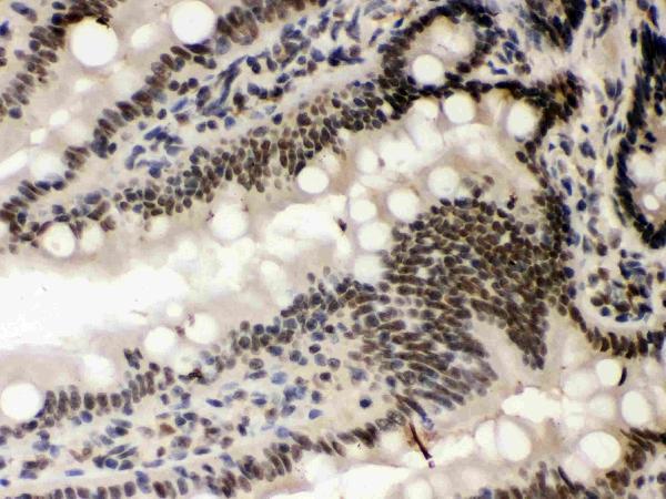 IHC analysis of CSNK1A1 using anti-CSNK1A1 antibody (PB9693). CSNK1A1 was detected in paraffin-embedded section of rat intestine tissues. Heat mediated antigen retrieval was performed in citrate buffer (pH6, epitope retrieval solution) for 20 mins. The tissue section was blocked with 10% goat serum. The tissue section was then incubated with 1μg/ml rabbit anti-CSNK1A1 Antibody (PB9693) overnight at 4°C. Biotinylated goat anti-rabbit IgG was used as secondary antibody and incubated for 30 minutes at 37°C. The tissue section was developed using Strepavidin-Biotin-Complex (SABC)(Catalog # SA1022) with DAB as the chromogen.