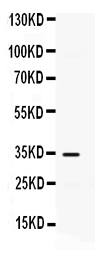 Western blot analysis of IP10 using anti-IP10 antibody (PB9695).