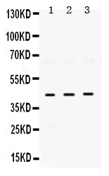 Western blot analysis of ELAVL4 using anti-ELAVL4 antibody (PB9698). Electrophoresis was performed on a 5-20% SDS-PAGE gel at 70V (Stacking gel) / 90V (Resolving gel) for 2-3 hours. The sample well of each lane was loaded with 50ug of sample under reducing conditions. Lane 1: rat brain tissue lysates, Lane 2: mouse brain tissue lysates, Lane 3: U87-MG whole cell lysates, After Electrophoresis, proteins were transferred to a Nitrocellulose membrane at 150mA for 50-90 minutes. Blocked the membrane with 5% Non-fat Milk/ TBS for 1.5 hour at RT. The membrane was incubated with rabbit anti-ELAVL4 antigen affinity purified polyclonal antibody (Catalog # PB9698) at 0.5 μg/mL overnight at 4°C, then washed with TBS-0.1%Tween 3 times with 5 minutes each and probed with a goat anti-rabbit IgG-HRP secondary antibody at a dilution of 1:10000 for 1.5 hour at RT. The signal is developed using an Enhanced Chemiluminescent detection (ECL) kit (Catalog # EK1002) with Tanon 5200 system. A specific band was detected for ELAVL4 at approximately 42KD. The expected band size for ELAVL4 is at 42KD.