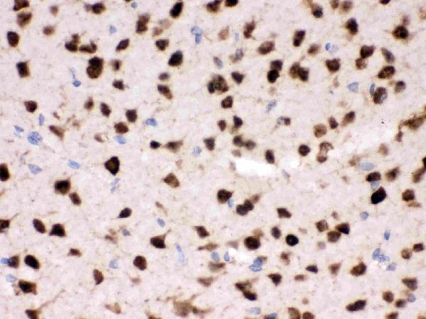 IHC analysis of ELAVL4 using anti-ELAVL4 antibody (PB9698). ELAVL4 was detected in paraffin-embedded section of mouse brain tissues. Heat mediated antigen retrieval was performed in citrate buffer (pH6, epitope retrieval solution) for 20 mins. The tissue section was blocked with 10% goat serum. The tissue section was then incubated with 1μg/ml rabbit anti-ELAVL4 Antibody (PB9698) overnight at 4°C. Biotinylated goat anti-rabbit IgG was used as secondary antibody and incubated for 30 minutes at 37°C. The tissue section was developed using Strepavidin-Biotin-Complex (SABC)(Catalog # SA1022) with DAB as the chromogen