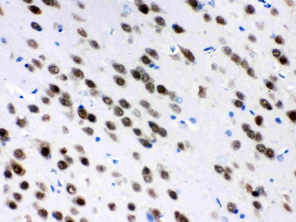 IHC analysis of ELAVL4 using anti-ELAVL4 antibody (PB9698). ELAVL4 was detected in paraffin-embedded section of rat brain tissues. Heat mediated antigen retrieval was performed in citrate buffer (pH6, epitope retrieval solution) for 20 mins. The tissue section was blocked with 10% goat serum. The tissue section was then incubated with 1μg/ml rabbit anti-ELAVL4 Antibody (PB9698) overnight at 4°C. Biotinylated goat anti-rabbit IgG was used as secondary antibody and incubated for 30 minutes at 37°C. The tissue section was developed using Strepavidin-Biotin-Complex (SABC)(Catalog # SA1022) with DAB as the chromogen