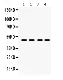 Western blot analysis of PAR2 using anti-PAR2 antibody (PB9700).