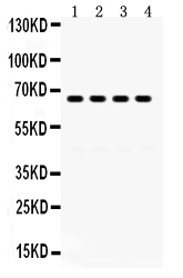 Western blot analysis of GRK6 using anti-GRK6 antibody (PB9709).