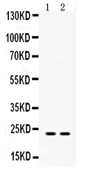 Western blot analysis of IGFBP5 using anti-IGFBP5 antibody (PB9711).