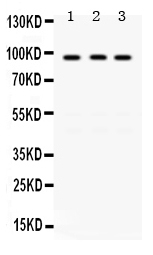 Western blot analysis of KAT2A/GCN5 using anti-KAT2A/GCN5 antibody (PB9713).