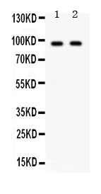 Western blot analysis of KIAA1524 using anti-KIAA1524 antibody (PB9714).