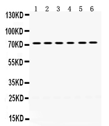 Western blot analysis of LIM kinase 2 using anti-LIM kinase 2 antibody (PB9717).