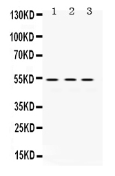 Western blot analysis of MMP1 using anti-MMP1 antibody (PB9725).