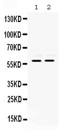 Western blot analysis of MMP8 using anti-MMP8 antibody (PB9726).