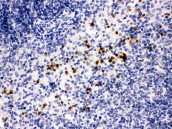 IHC analysis of MMP8 using anti-MMP8 antibody (PB9727).