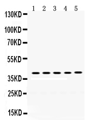 Western blot analysis of Oncostatin M using anti-Oncostatin M antibody (PB9732).