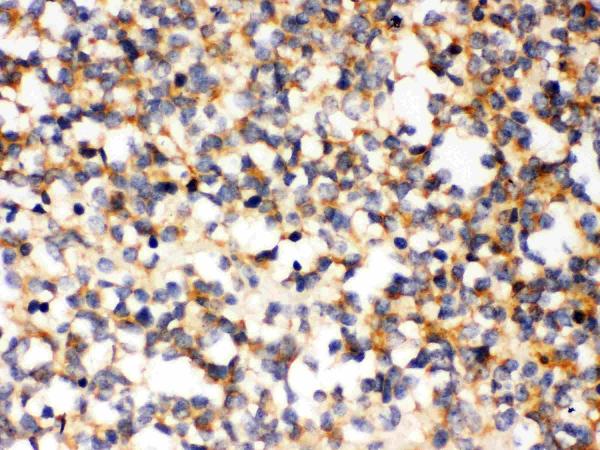 IHC analysis of PAK5 using anti-PAK5 antibody (PB9733).