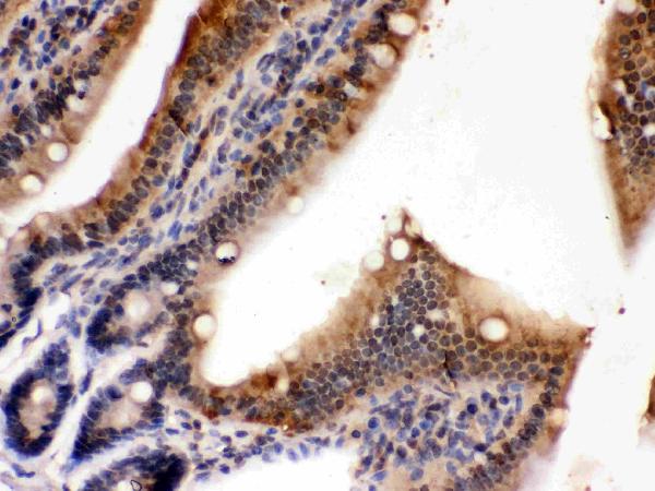 IHC analysis of PDPK1 using anti-PDPK1 antibody (PB9735).