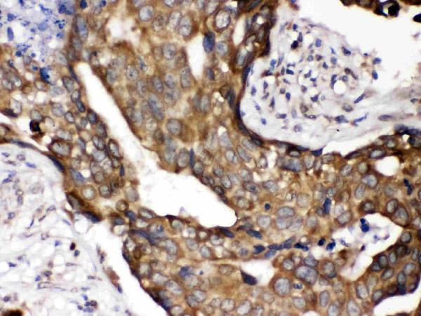 IHC analysis of POR using anti-POR antibody (PB9736).