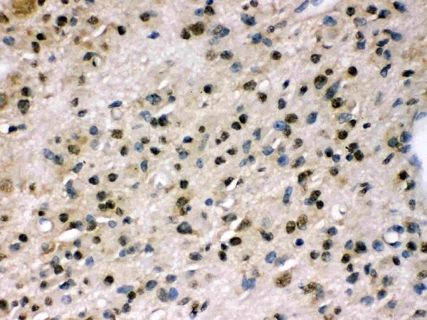 IHC analysis of PPP1R12A using anti-PPP1R12A antibody (PB9737).