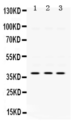 Western blot analysis of AMPK beta 1 using anti-AMPK beta 1 antibody (PB9738).