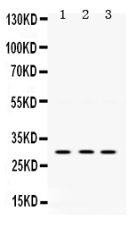 Western blot analysis of AMPK beta 2 using anti-AMPK beta 2 antibody (PB9739).