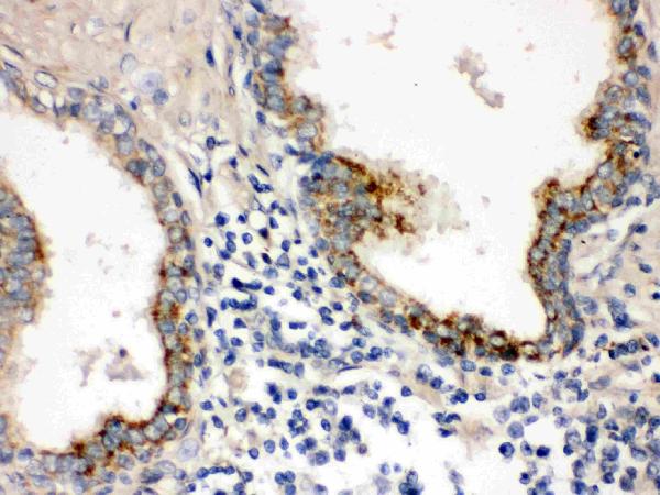 IHC analysis of PTP4A2 using anti-PTP4A2 antibody (PB9740).