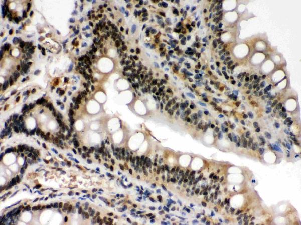 IHC analysis of c-Rel using anti-c-Rel antibody (PB9741).