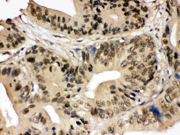 IHC analysis of SMC3 using anti-SMC3 antibody (PB9746).