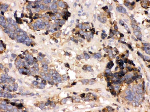 IHC analysis of Prealbumin using anti-Prealbumin antibody (PB9749).