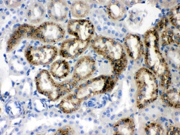 IHC analysis of Prealbumin using anti-Prealbumin antibody (PB9750).