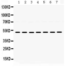 Western blot analysis of ADRA1A using anti-ADRA1A antibody (PB9752).