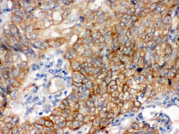 IHC analysis of Bag3 using anti-Bag3 antibody (PB9754).