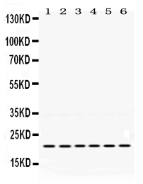 Western blot analysis of Bik using anti-Bik antibody (PB9755). Electrophoresis was performed on a 5-20% SDS-PAGE gel at 70V (Stacking gel) / 90V (Resolving gel) for 2-3 hours. The sample well of each lane was loaded with 50ug of sample under reducing conditions. Lane 1: Rat Spleen Tissue Lysate, Lane 2: Rat Gaster Tissue Lysate, Lane 3: Rat Intestine Tissue Lysate, Lane 4: MCF-7 Whole Cell Lysate, Lane 5: A549 Whole Cell Lysate, Lane 6: SKOV Whole Cell Lysate. After Electrophoresis, proteins were transferred to a Nitrocellulose membrane at 150mA for 50-90 minutes. Blocked the membrane with 5% Non-fat Milk/ TBS for 1.5 hour at RT. The membrane was incubated with rabbit anti-Bik antigen affinity purified polyclonal antibody (Catalog # PB9755) at 0.5 μg/mL overnight at 4°C, then washed with TBS-0.1%Tween 3 times with 5 minutes each and probed with a goat anti-rabbit IgG-HRP secondary antibody at a dilution of 1:10000 for 1.5 hour at RT. The signal is developed using an Enhanced Chemiluminescent detection (ECL) kit (Catalog # EK1002) with Tanon 5200 system. A specific band was detected for Bik at approximately 22KD. The expected band size for Bik is at 22KD.