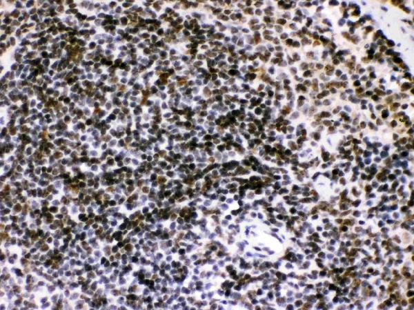 IHC analysis of Bik using anti-Bik antibody (PB9755). Bik was detected in paraffin-embedded section of Mouse Spleen Tissue. Heat mediated antigen retrieval was performed in citrate buffer (pH6, epitope retrieval solution) for 20 mins. The tissue section was blocked with 10% goat serum. The tissue section was then incubated with 1μg/ml rabbit anti-Bik Antibody (PB9755) overnight at 4°C. Biotinylated goat anti-rabbit IgG was used as secondary antibody and incubated for 30 minutes at 37°C. The tissue section was developed using Strepavidin-Biotin-Complex (SABC)(Catalog # SA1022) with DAB as the chromogen.