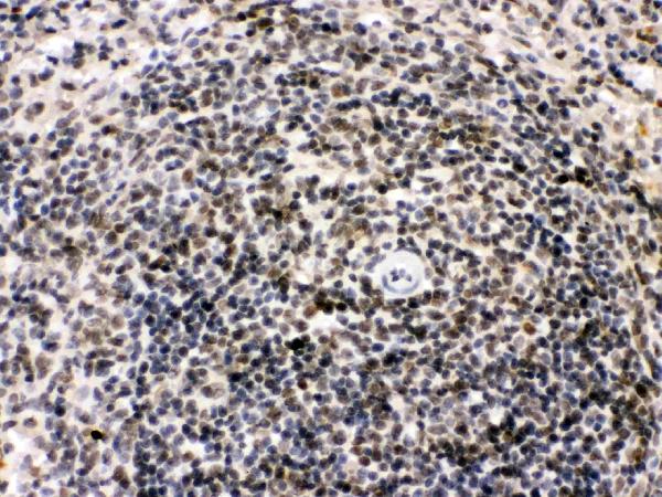 IHC analysis of Bik using anti-Bik antibody (PB9755). Bik was detected in paraffin-embedded section of Rat Spleen Tissue. Heat mediated antigen retrieval was performed in citrate buffer (pH6, epitope retrieval solution) for 20 mins. The tissue section was blocked with 10% goat serum. The tissue section was then incubated with 1μg/ml rabbit anti-Bik Antibody (PB9755) overnight at 4°C. Biotinylated goat anti-rabbit IgG was used as secondary antibody and incubated for 30 minutes at 37°C. The tissue section was developed using Strepavidin-Biotin-Complex (SABC)(Catalog # SA1022) with DAB as the chromogen.