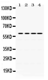 Western blot analysis of Cdc25C using anti-Cdc25C antibody (PB9756).