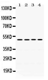 Western blot analysis of DDB2 using anti-DDB2 antibody (PB9757).