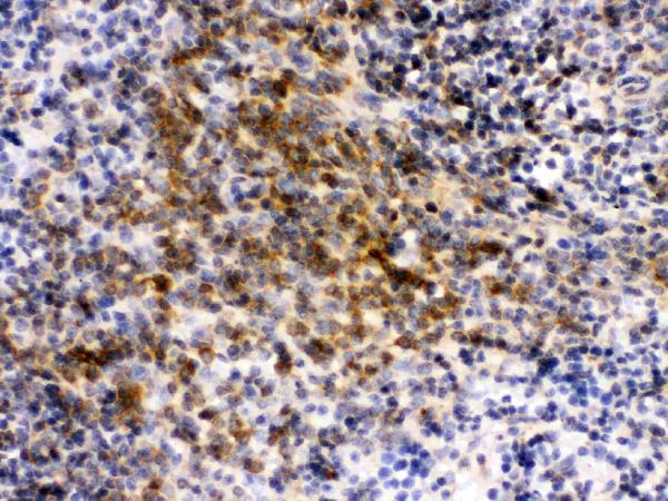 IHC analysis of eIF4A2 using anti-eIF4A2 antibody (PB9758).