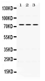 Western blot analysis of IL2RB using anti-IL2RB antibody (PB9761).