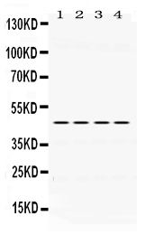 Western blot analysis of PAX6 using anti-PAX6 antibody (PB9768).