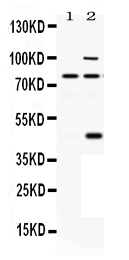 Western blot analysis of PACE4 using anti-PACE4 antibody (PB9769).