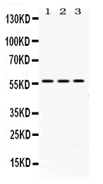 Western blot analysis of ERp57 using anti-ERp57 antibody (PB9772).