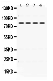 Western blot analysis of PIGR using anti-PIGR antibody (PB9776).