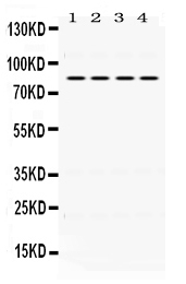 Western blot analysis of PIK3R2 using anti-PIK3R2 antibody (PB9777).