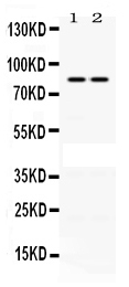 Western blot analysis of PLA2G4A using anti-PLA2G4A antibody (PB9778).