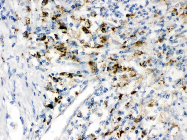 IHC analysis of PPT1 using anti-PPT1 antibody (PB9781).