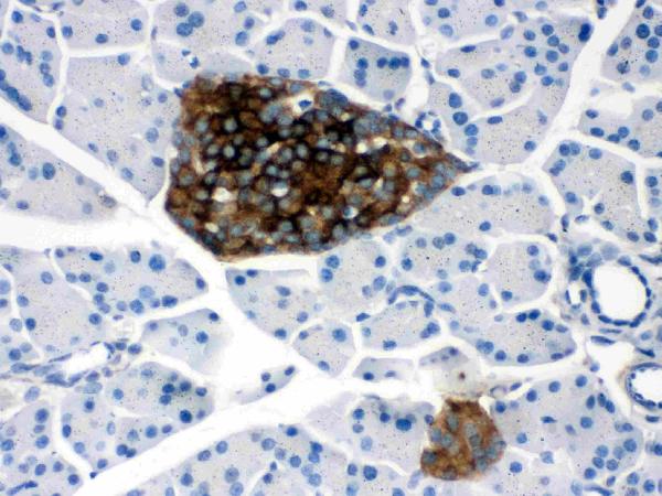 IHC analysis of PRNP using anti-PRNP antibody (PB9783).