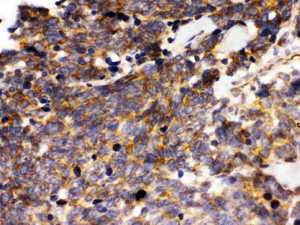 IHC analysis of LAR using anti-LAR antibody (PB9786).