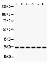 Western blot analysis of Rab5 using anti-Rab5 antibody (PB9787).